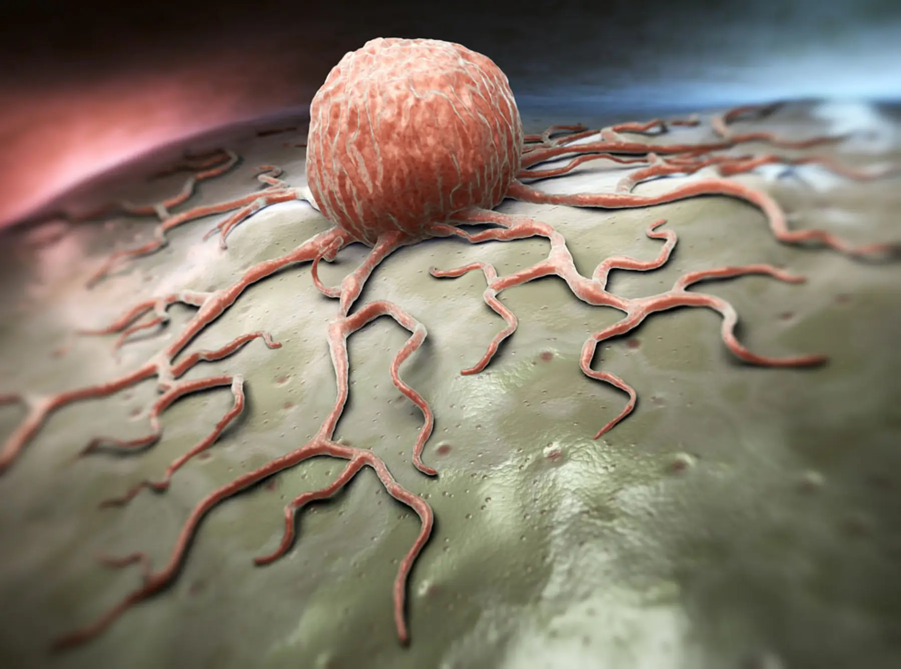 بیش از یک‌سوم موارد بیماری سرطان قابل پیشگیری است